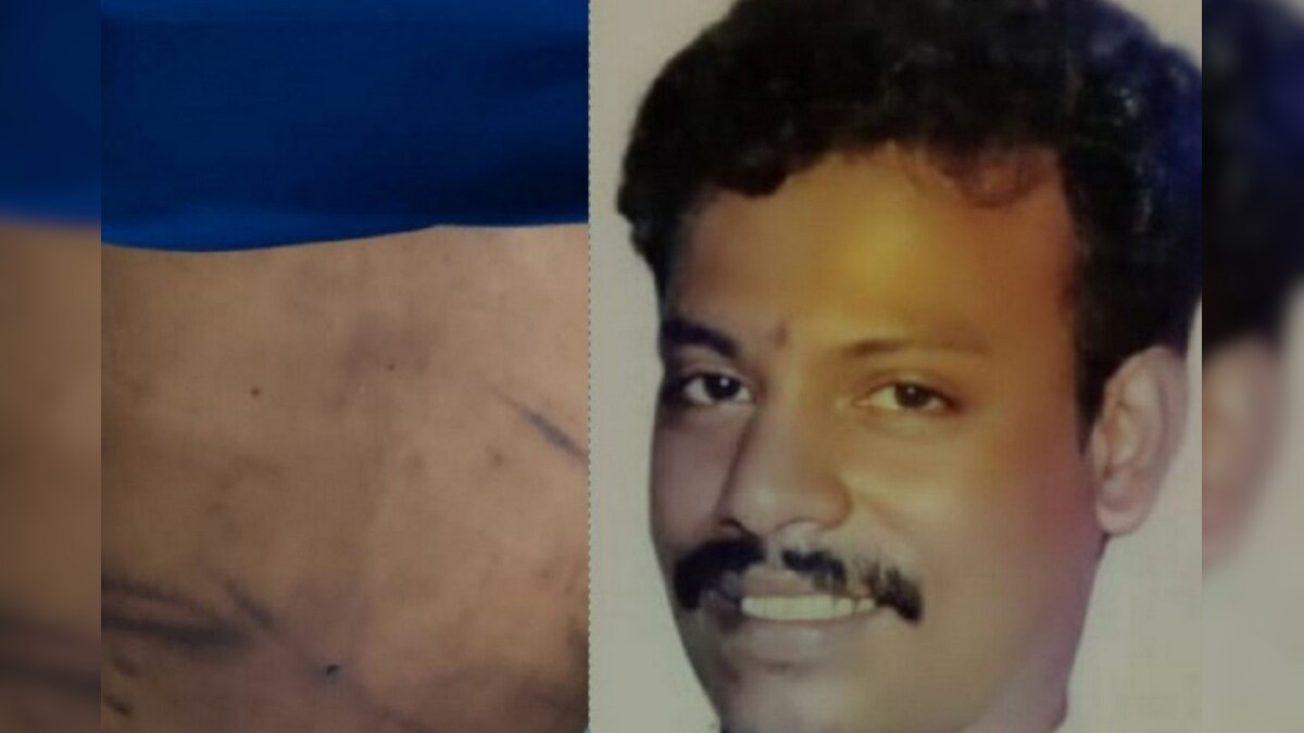 போதை மறுவாழ்வு மையத்தில் சேர்க்கப்பட்ட நபர் மர்ம மரணம் – அடித்தே கொன்றதாக உறவினர்கள் புகார் | தமிழ்நாடு
