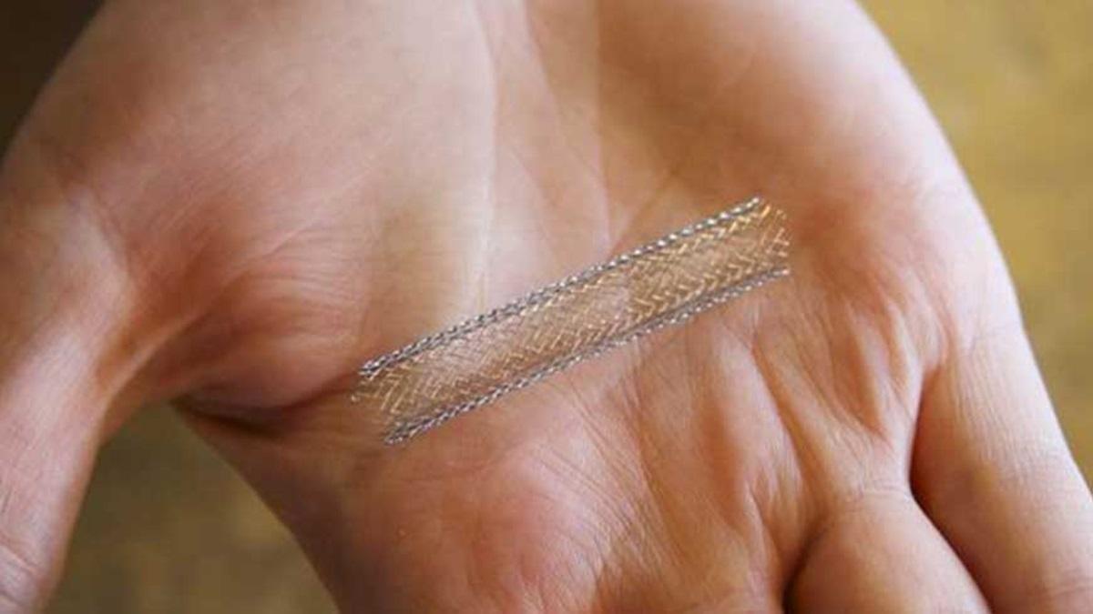 இந்​தி​யா​வில் தயாரிக்​கப்​பட்ட புதிய தலை​முறை இதய ஸ்டென்ட்​டுக்கு உலகளா​விய அங்​கீ​காரம் கிடைத்​துள்​ளது | New generation heart stent made in India receives global approval